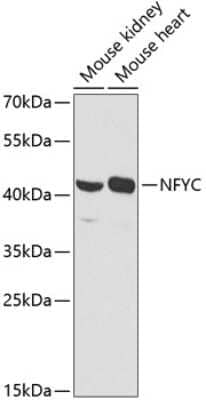 Western Blot: NFYC Antibody [NBP2-93399] - Western blot analysis of extracts of various cell lines, using NFYC antibody (NBP2-93399) at 1:1000 dilution. Secondary antibody: HRP Goat Anti-Rabbit IgG (H+L) at 1:10000 dilution. Lysates/proteins: 25ug per lane. Blocking buffer: 3% nonfat dry milk in TBST. Detection: ECL Basic Kit. Exposure time: 90s.